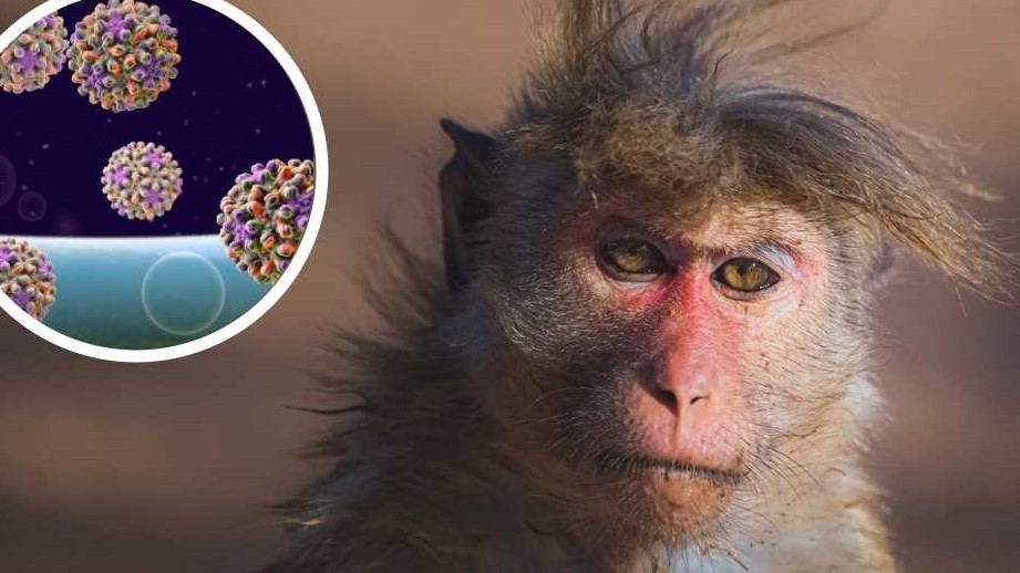 http://fronteradigital.com.ve/Viruela del mono: qué es esta enfermedad detectada en Europa y Norteamérica 
y qué riesgos entraña para la salud