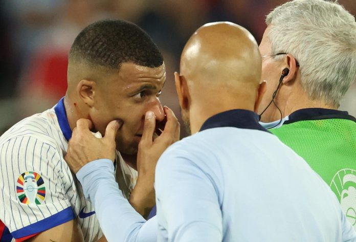 Diario Frontera, Frontera Digital,  Deportes, ,Eurocopa 2024: Mbappé no será operado y jugará con una máscara facial