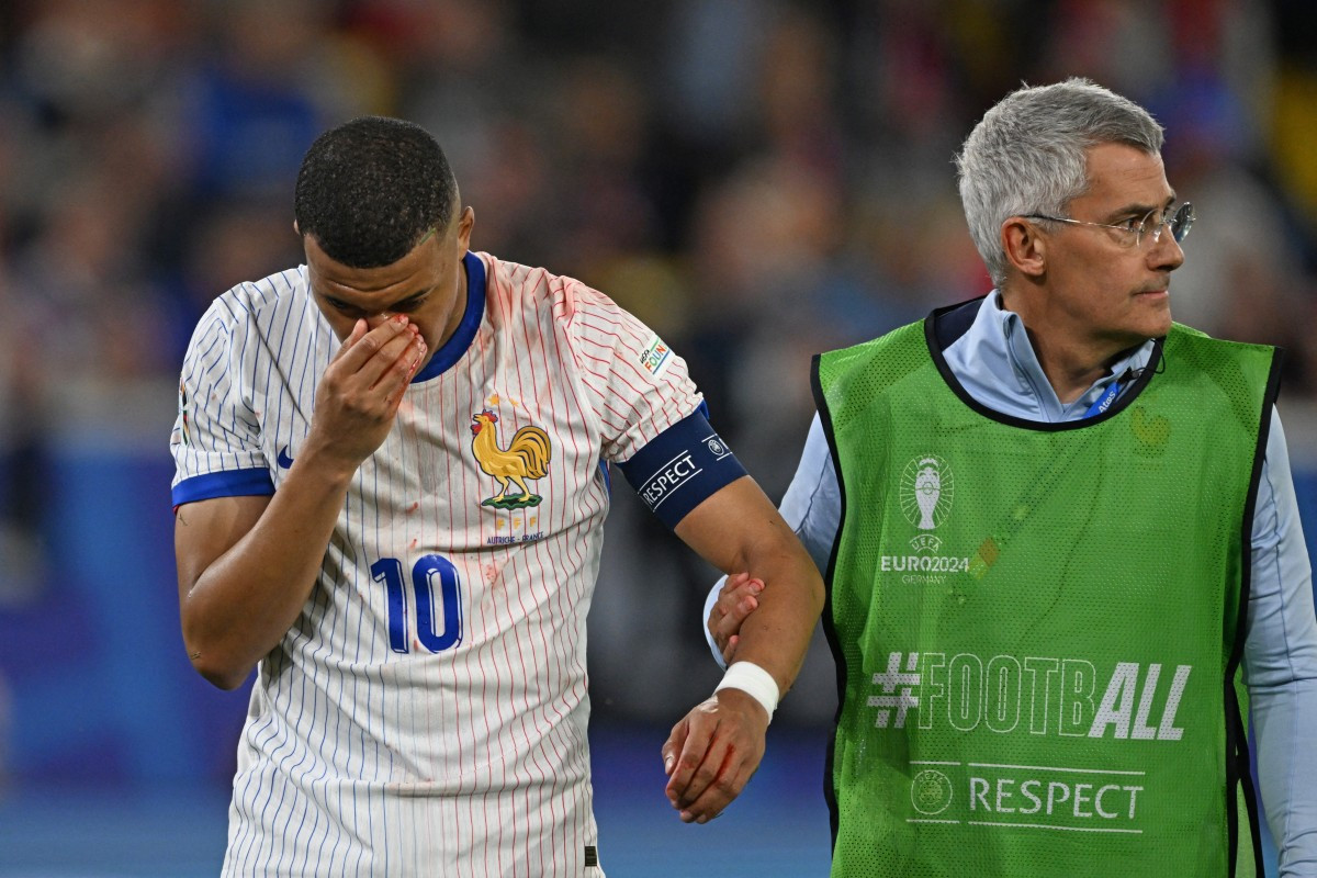 Diario Frontera, Frontera Digital,  Deportes, ,Francia gana, pero Mbappé podría perderse lo que resta de Eurocopa