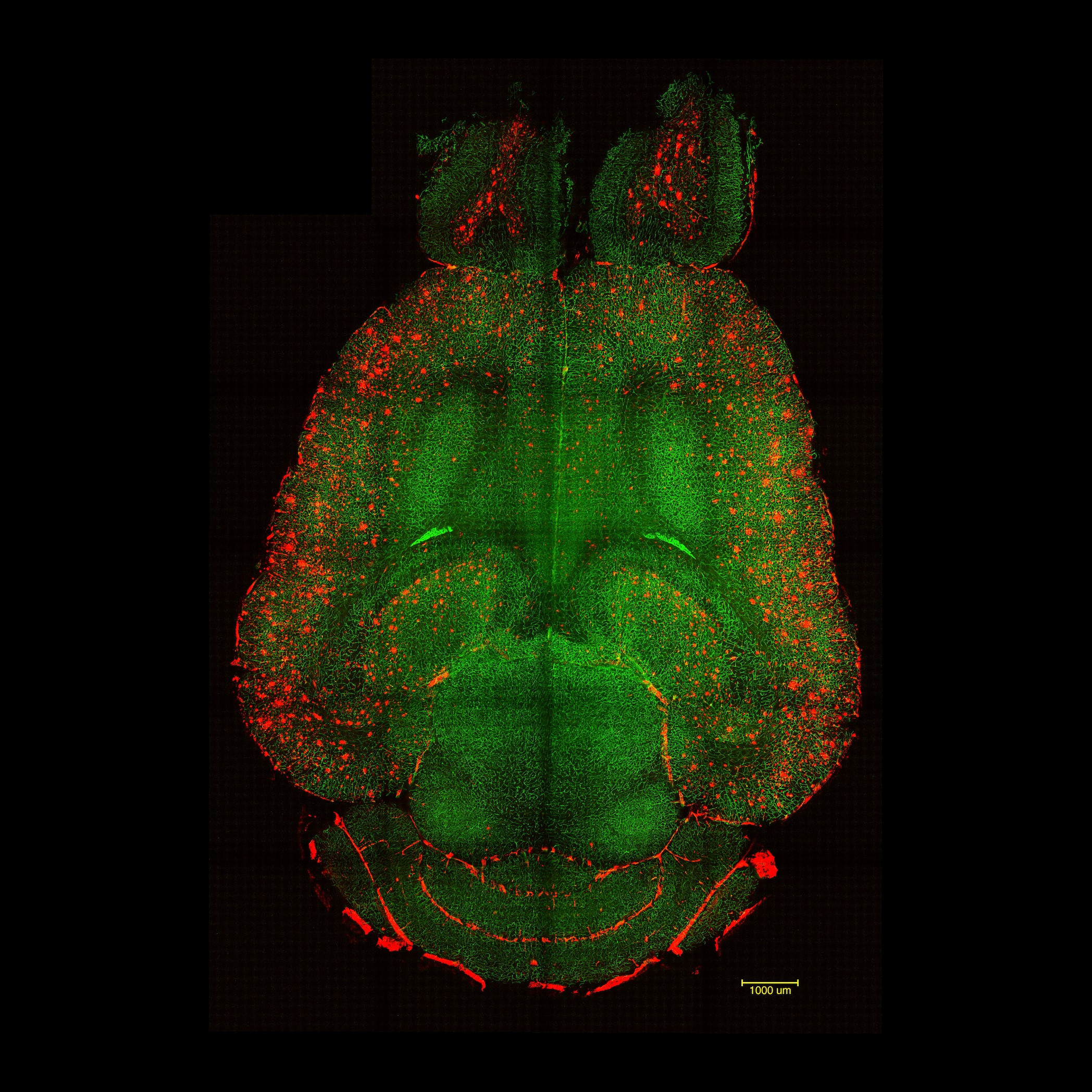 Diario Frontera, Frontera Digital,  Salud, ,Imágenes de microscopía de fluorescencia basada en hoja de luz del cerebro de un ratón 12 horas después de no haber sido tratado con nanopartículas IBEC,Una terapia con nanopartículas revierte el alzhéimer en ratones