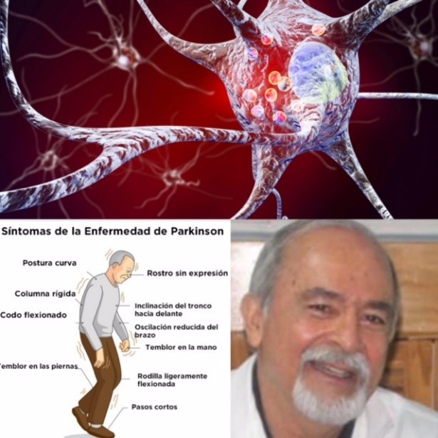  Opinión, 