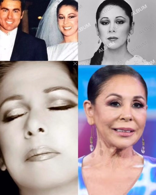 Opinión,