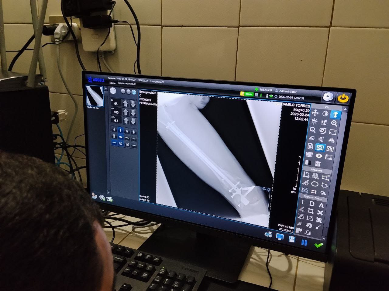 Diario Frontera, Frontera Digital,  Regionales, ,Reactivado el servicio de rayos X 24 horas en el CDI de Los Sauzales
