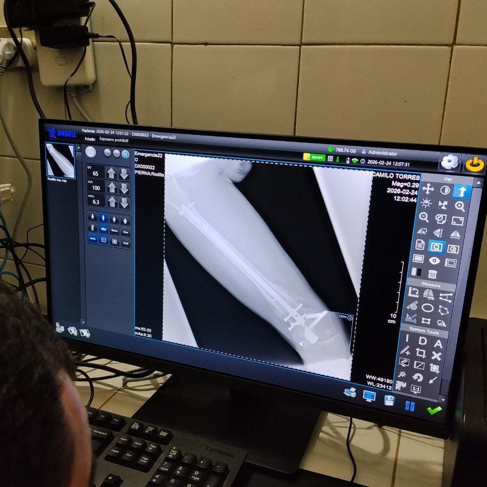 Diario Frontera, Frontera Digital,  Regionales, ,Reactivado el servicio de rayos X 24 horas en el CDI de Los Sauzales